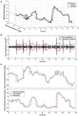 Eye Movement Evaluation in Multiple Sclerosis and Parkinson's Disease Using a Standardized Oculomotor and Neuro-Ophthalmic Disorder Assessment (SONDA)